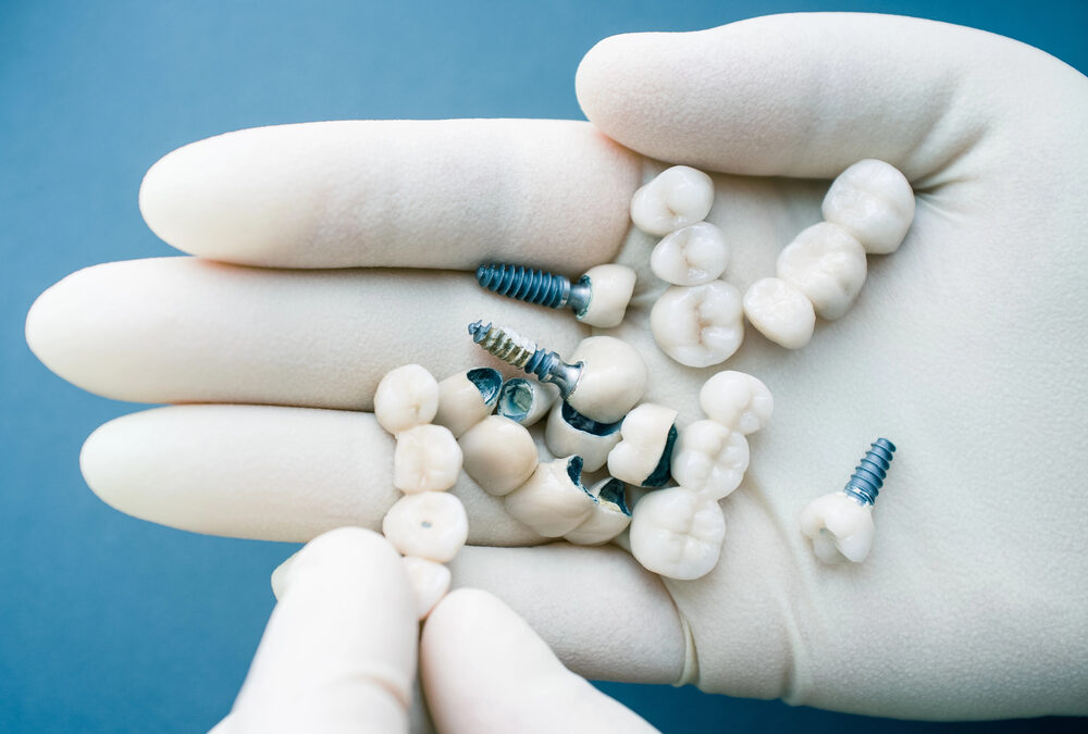 dental implants and dentures