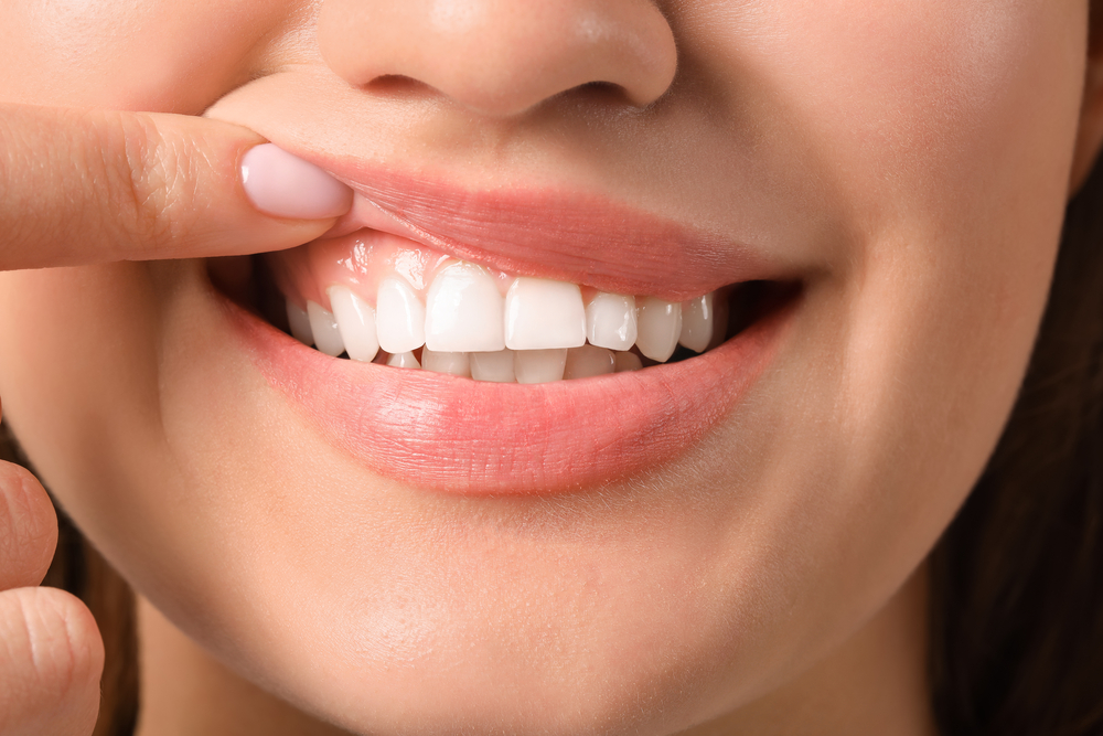 Healthy Gums, Healthy Life: The Essential Guide to Oral Health