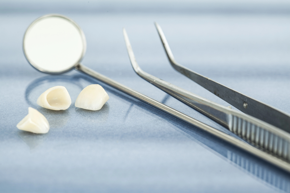 dental crowns and bridges