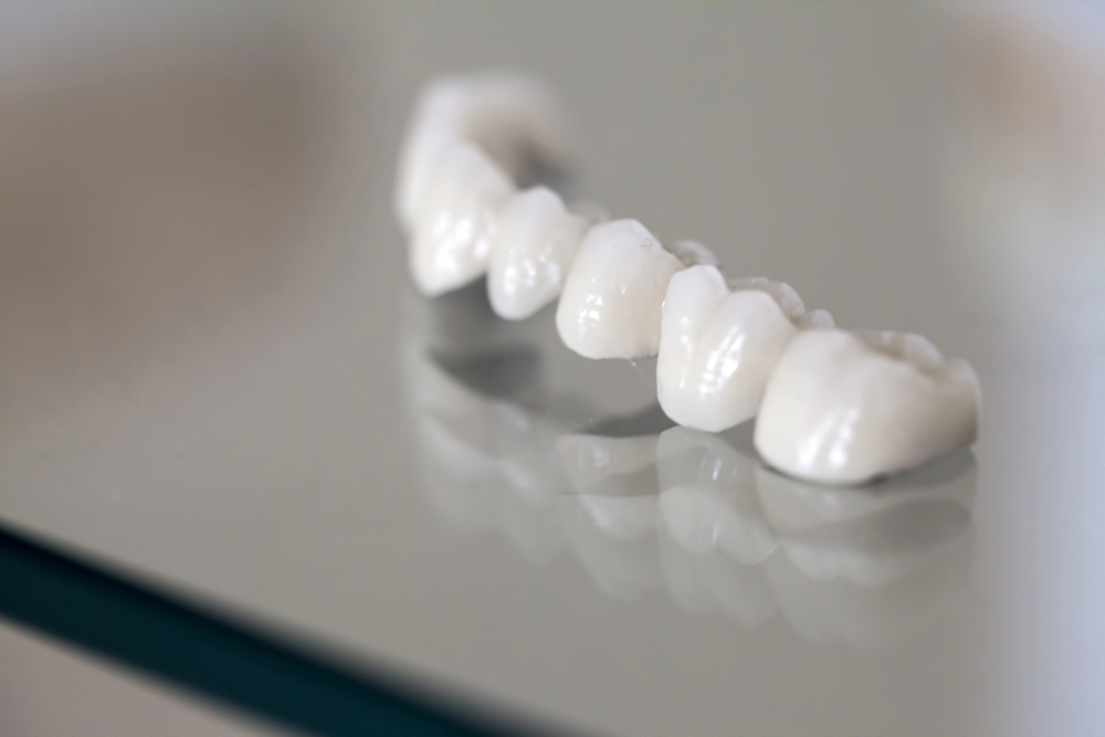 Dental Crown