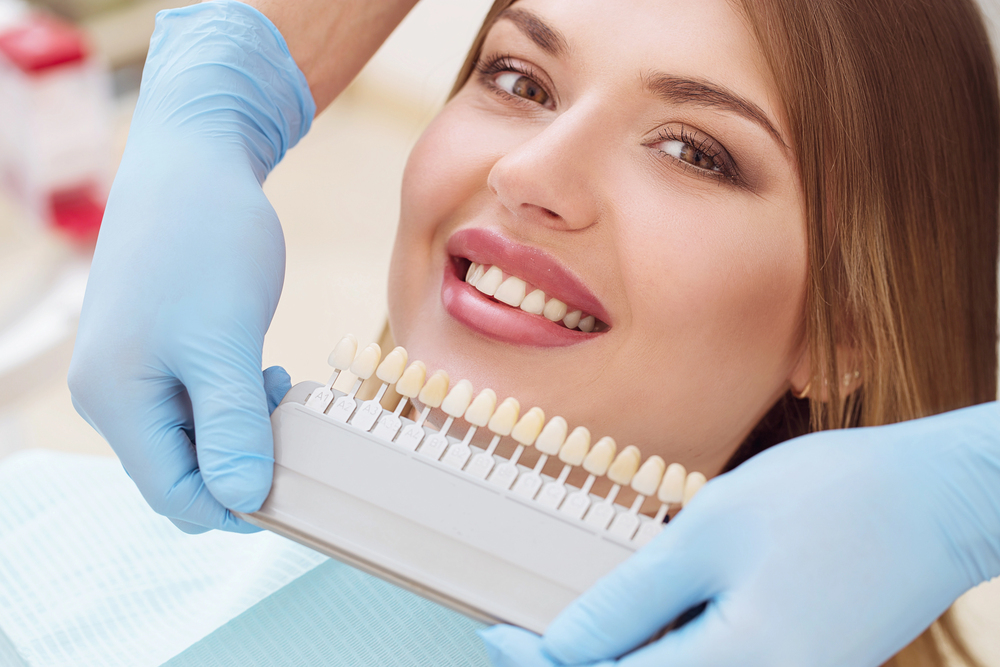 Thinking About Dental Veneers? A Dentist-Backed Guide to a Natural-Looking Smile