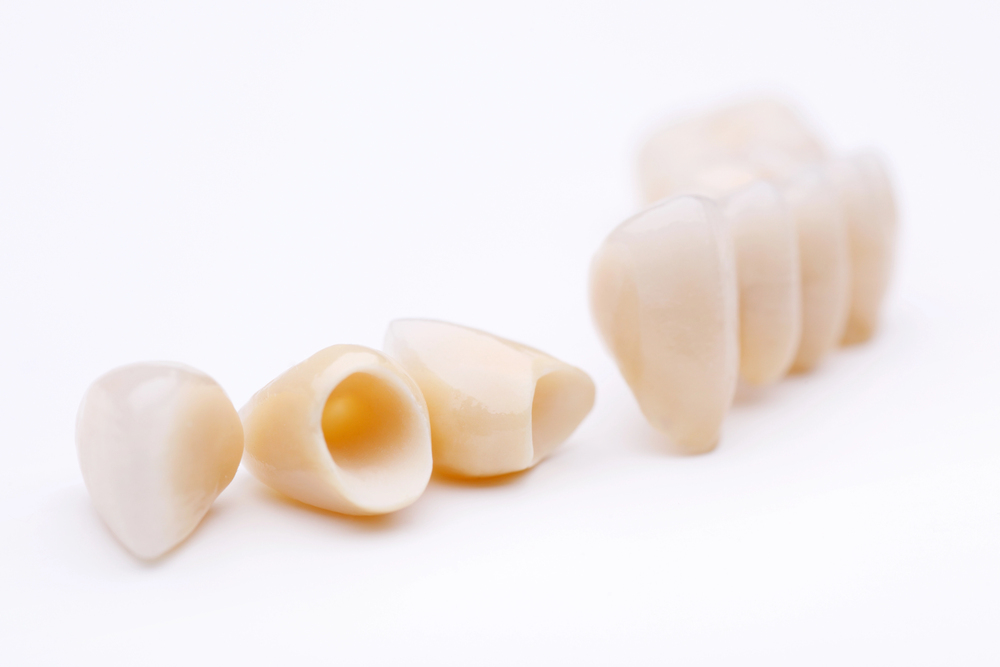 Living Better with Dental Crowns: How Modern Restorations Fit Your Daily Life