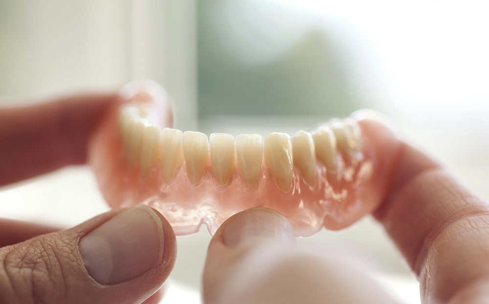 overdentures